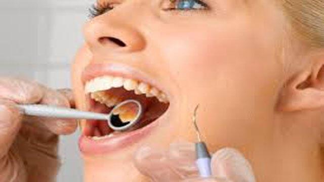 Mor diş eti tedavisi nedir? Sağlık Haberleri