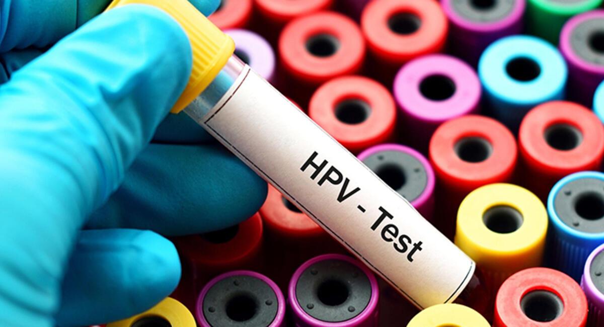 hpv virusunun tedavisi nedir
