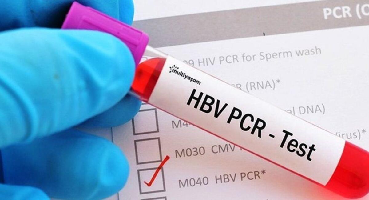 koronavirus test fiyati ne kadar pcr testi ucretleri ne kadar pcr testi fiyat 2020 saglik haberleri
