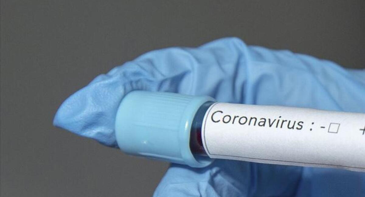koronavirus belirtileri nelerdir kac gunde belli olur gunun haberleri