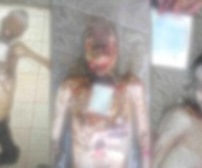 Suriye'de işkence fotoğrafları