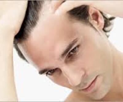 Erkeklerde saç dökülmesi neden olur? 