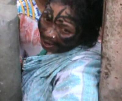 Hindistan'da büyücü olduğu gerekçesiyle bir kadını dövdüler