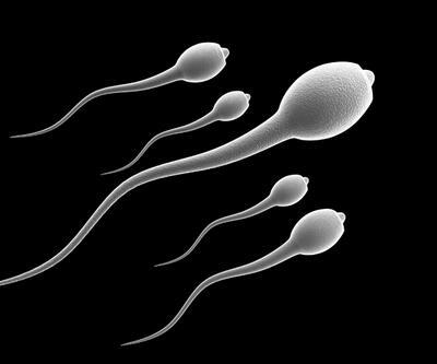 Sperm sayısı giderek azalıyor mu? 