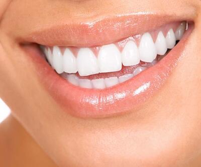 Dişler arasındaki boşluklar nasıl kapanır?