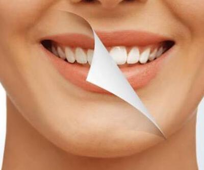 Diş beyazlatmak zararlı mı?