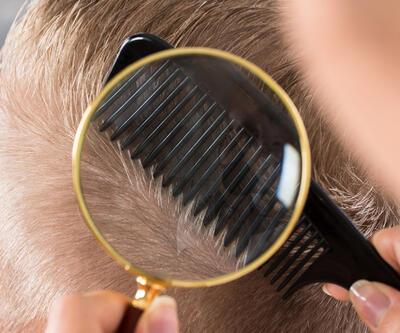 Saç dökülmesinde PRP uygulamalarının faydaları