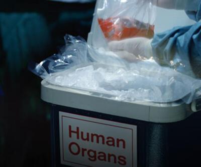 Türk Böbrek Vakfı'nı arayıp 'organ satmak istiyorum' diyorlar