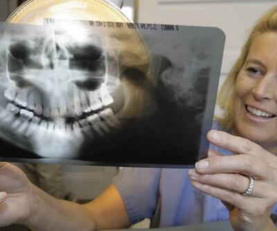 Yıllardır burnu tıkalı kadının ameliyatında şok: Burnunun içinde diş çıktı