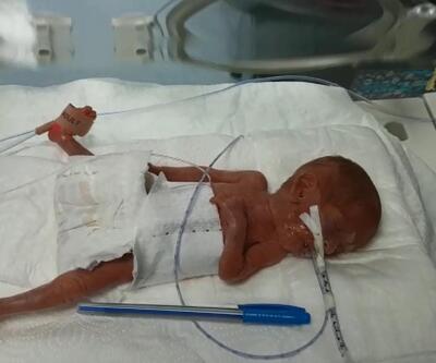 Türkiye’de bir ilk! 285 gram doğan Elçin bebek hayata tutundu