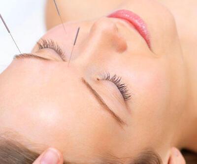Kadın hastalıklarında akupunktur tedavisi 