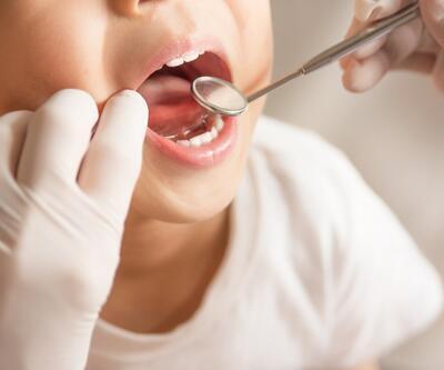 "Biberon çürüğü çocukların diş sağlığını olumsuz etkiliyor"