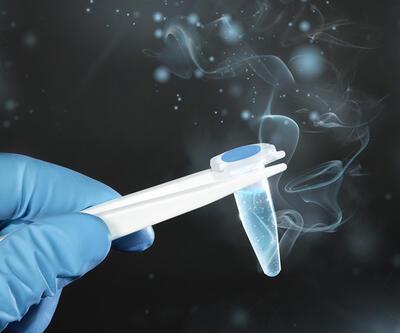 Sperm testi nedir? Sperm örneği verilirken nelere dikkat edilmeli? 