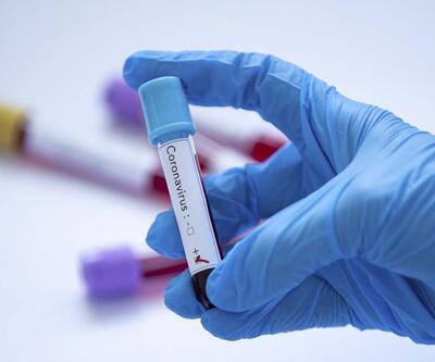 Kan grubu “O” veya "negatif" olanların koronavirüse yakalanma riski daha az