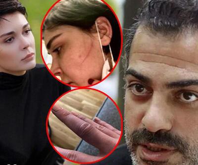 Son dakika!  Sevcan Yaşar: Sermiyan Midyat dövüp çıplak videomu çekti