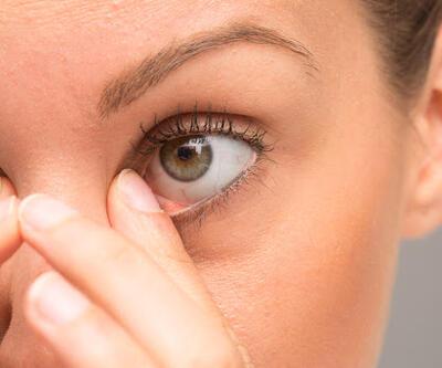 Göz Bebeği Hastalıkları Nelerdir? Anizokori Ve Eşit Büyüklükte Olmayan Göz Bebekleri Nasıl Geçer?
