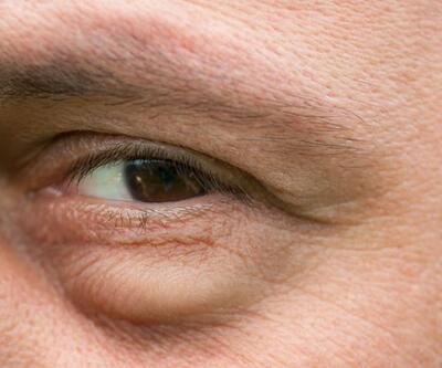 50 yaş üzerindeki kişilere önemli uyarı: Gözlerdeki bu belirtileri ihmal etmeyin!