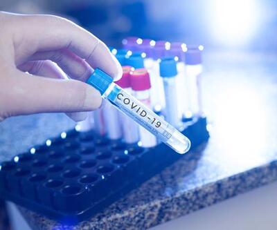 İşçi PCR testi zorunluluğu ne zaman başlıyor? PCR testi kimlere zorunlu?