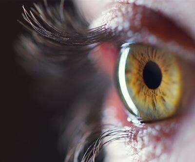 Sarı nokta hastalığı nedir? COVID-19 sürecinde sarı nokta hastalığı hafife alınmamalı!
