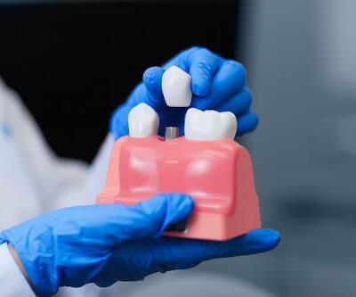 "Diş kaybı sorunlarında implant tedavisi en çok tercih edilen çözümler arasında”