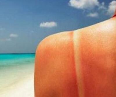 Uzun süreli güneş teması deri kanserlerinin görülme oranını artırdı