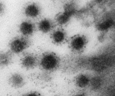 Koronavirüsün delta varyantı Rusya'da görüntülendi