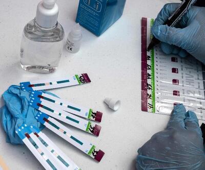 AIDS aşısının insan üzerinde faz-1 denemesi başladı