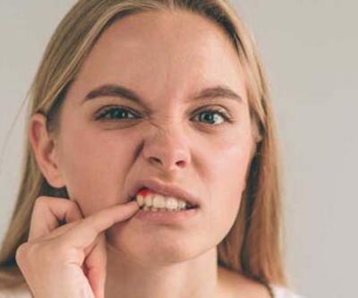 Covid ve diş eti hastalıkları arasındaki bağlantı ortaya çıktı! Bu belirtilere dikkat 