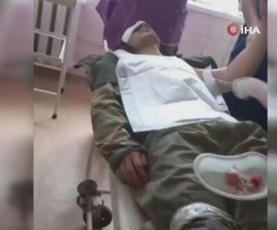 Yaralı Rus askeri, Ukraynalı doktor tedavi etti