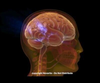 Beyin yapısı suç oranını etkiliyor mu?