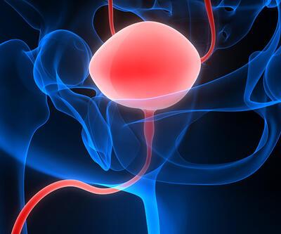 Prostat kanserinin tedavisinde teranostik yaklaşım nedir?