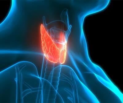 Tiroid kanserinde radyoaktif iyot tedavisi, kime uygulanır?