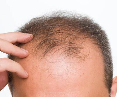 Saç dökülmesi yaşayan erkekler bunları tüketebilir