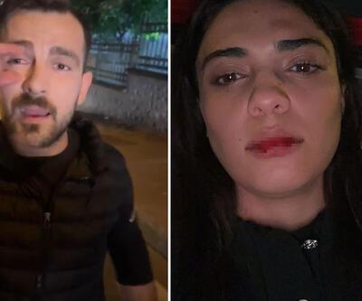 Azerbaycanlı şarkıcı Nergiz Bagieva saldırıya uğradı