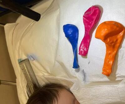 1 yaşındaki bebeğin midesinden 3 balon çıkarıldı