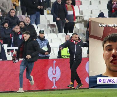 Sivasspor-Fiorentina maçında rakibe yumruklu saldırı! Kanlar içinde kaldı