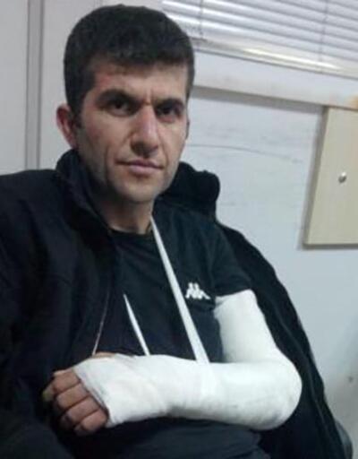 Grup Yorum üyesi Ali Aracı'nın gözaltında kolunu kırdılar