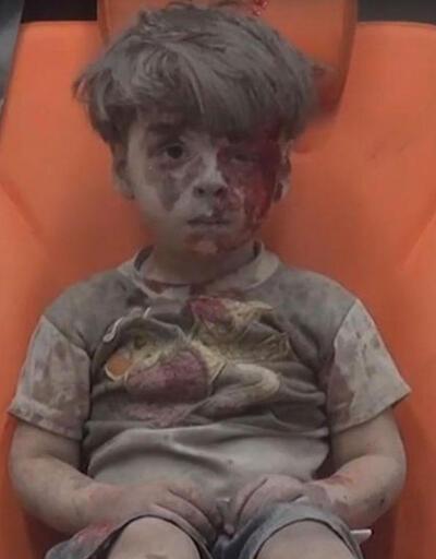 5 yaşındaki Suriyeli Ümran Dakneş dünyaya küs