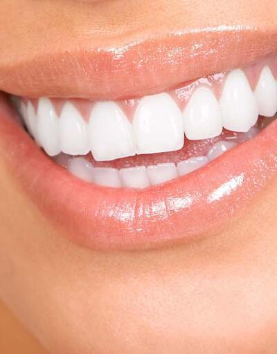 Dişler arasındaki boşluklar nasıl kapanır?