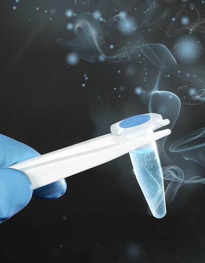 Sperm testi nedir? Sperm örneği verilirken nelere dikkat edilmeli? 