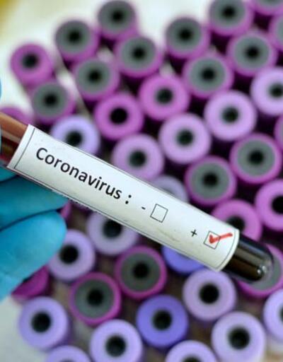 Canan Karatay: "Korona virüsüne karşı aşı yapamazsınız"