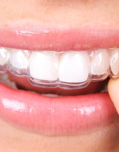 Ortodonti tedavisinde saklı tel nedir?