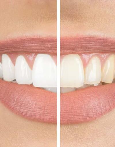 Sağlıklı dişler için altın kurallar   