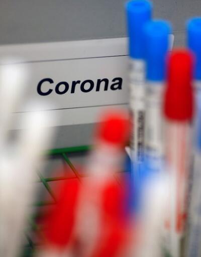 Dikkat! Herkesi ilgilendiriyor: Koronavirüs sürecinde sağlık sigortasına 14 gün kuralı  