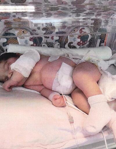 Doğumhanede ısıtıcıyla yanan bebeğin ailesine 160 bin lira tazminat