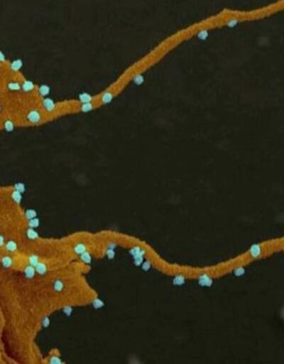 Son dakika: Bilim insanları koronavirüsün kollarını görüntüledi | Video