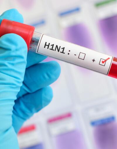 Çin’de yeni virüs paniği: G4 H1N1 'domuz gribi' nedir? Pandemik potansiyele sahip!
