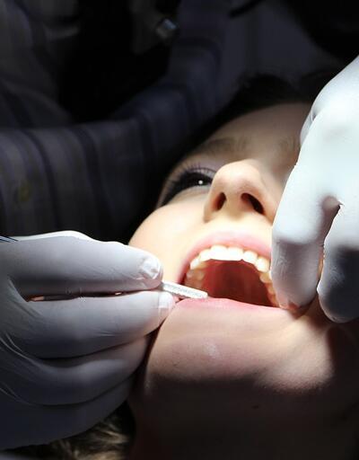 Diş çürükleri koronavirüse yakalanma riskini artırıyor