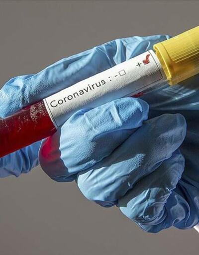 ABD'den evde yapılabilen koronavirüs testine onay
