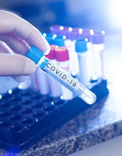 İşçi PCR testi zorunluluğu ne zaman başlıyor? PCR testi kimlere zorunlu?